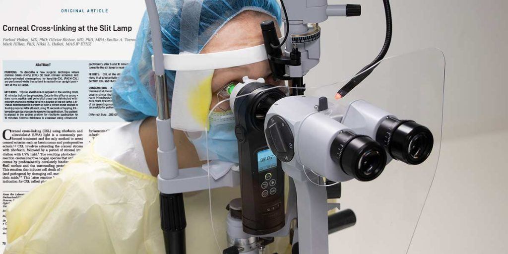 Cross-Linking at the Slit Lamp now published in the Journal of Refractive Surgery (JRS)