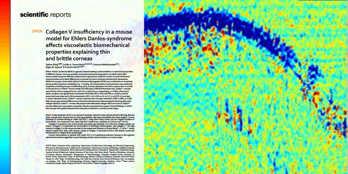 New insights into EhlersDanlos syndrome The ELZA Institute