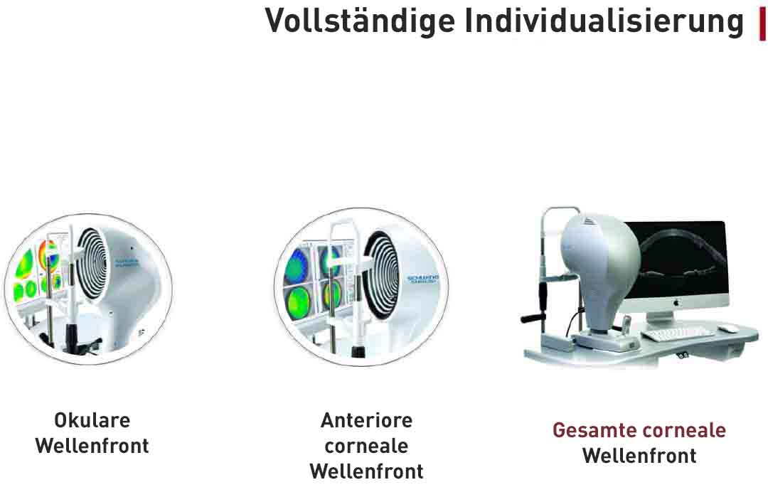 Total Corneal Wavefront Analysis System - Eine Illustration des fortschrittlichen Systems zur Analyse der gesamten cornealen Wellenfront, das die Placido-Scheiben-Corneatopographie und die hochauflösende OCT-basierte Tomographie des vorderen Augenabschnitts kombiniert.
